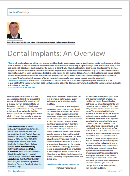 Dental Implants An Overview