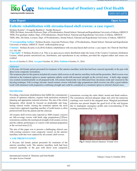 Esthetic rehabilitation with zirconia-based shell crowns: a case report