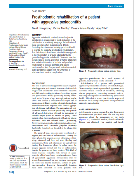 Prosthodontic rehabilitation of a patient with aggressive periodontitis