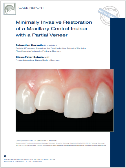 Minimally Invasive Restoration of a Maxillary Central Incisor with a Partial Veneer